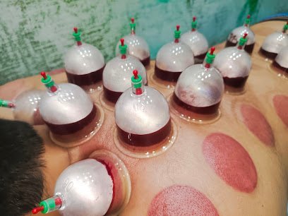 Al Mirage Hijama Cupping Center