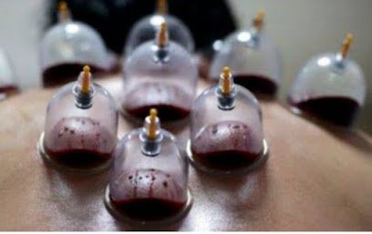 Islamic Hijama Centre