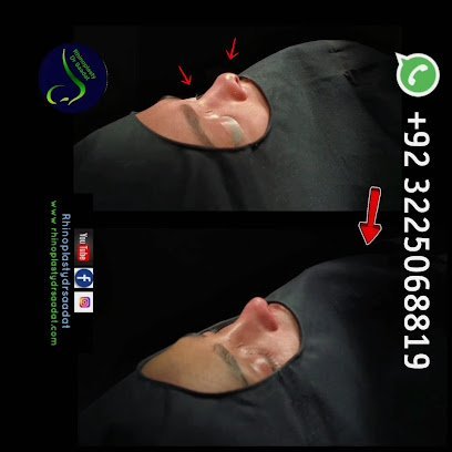 Rhinoplasty Dr Saadat