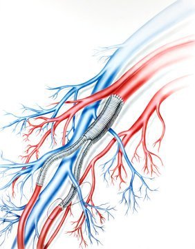 Vascular Surgeon, Dr Azeem