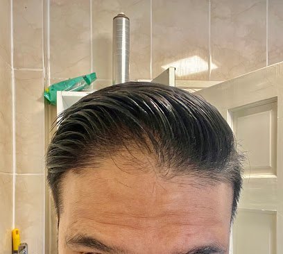 Miracles Hair Transplant