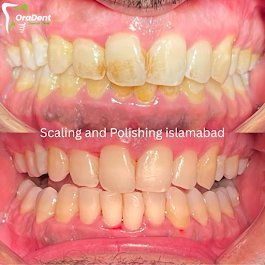 Oral Dent Dental Clinic