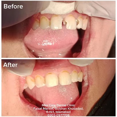 Max Care Dental Clinic