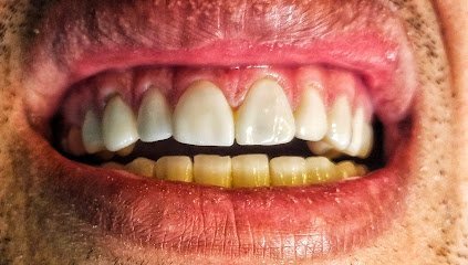 Maxodent Dental Clinic And Implant Center