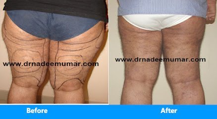 Dr. Nadeem Umar'S Cosmos Clinic