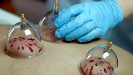 Glamorous Hijama Centre Islamabad