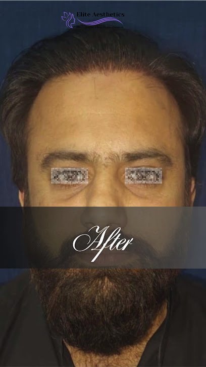 Elite Aesthetics Plastic Surgery Consultants