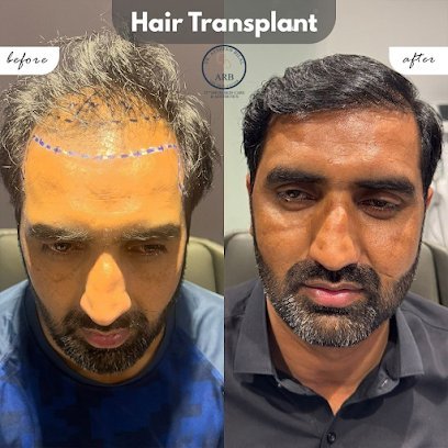 Arb Hair Transplant