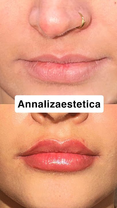 Annaliza Estetica Clinic
