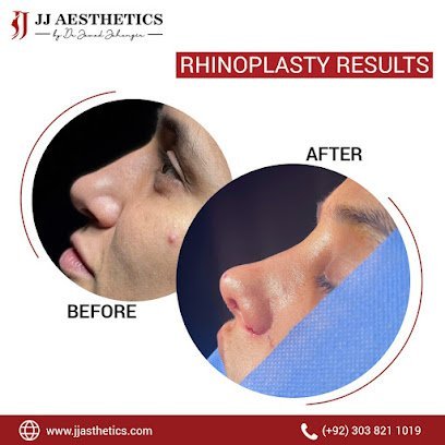 Best Rhinoplasty Surgeon In Islamabad | Nose Job | Revision Rhinoplasty