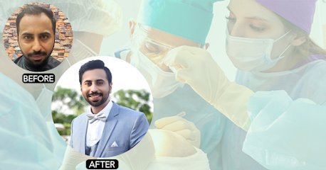 Hair Transplant Extent International