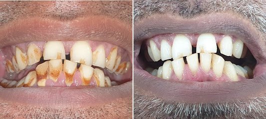 Yasir Dental Care