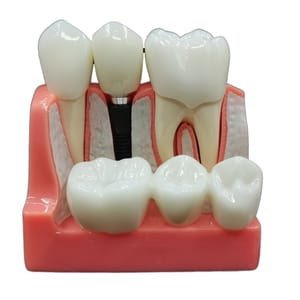 Dental House#ڈینٹل_ہائوس#Tooth_Care#_Dental Clinic_North_Nazimabad_#Dentist_Near_By_Me