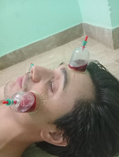 Hijama Home Services By Dr Aleem