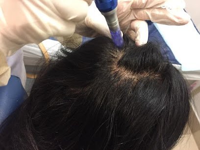 The Cupping Clinic