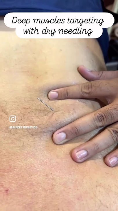 Dr Haider Physical Therapy & Dry Needling Specialist