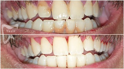 Yasir Dental Care