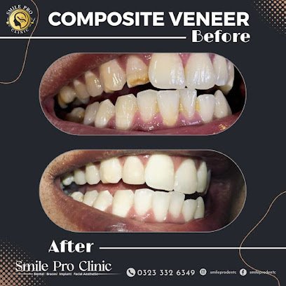 Smile Pro Dental And Aesthetic Clinic