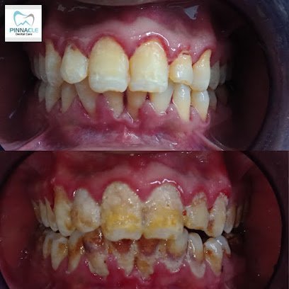 Pinnacle Dental Care