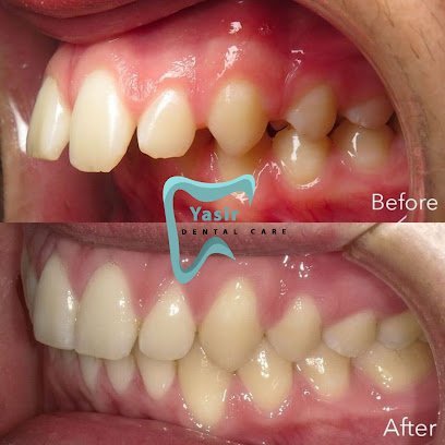 Yasir Dental Care