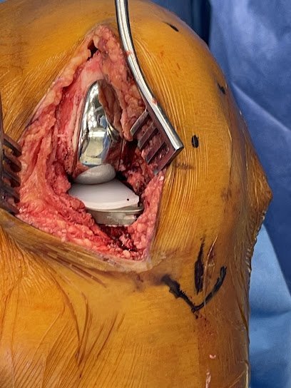 Orthopedics Hip Knee Surgery