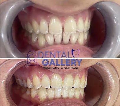 Dental Gallery