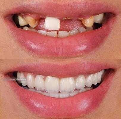 Zain Dental Clinic