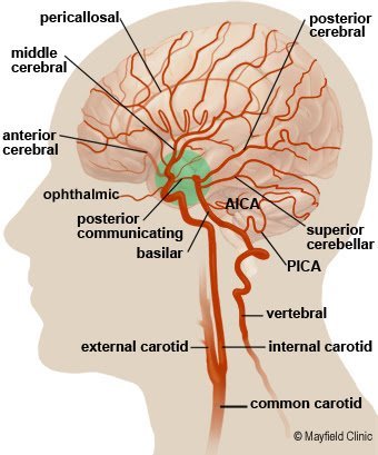 Syed Neurosurgery Ct Scan Complex