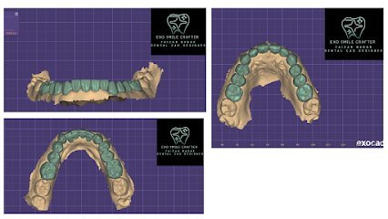 Exosmile Crafter (Dental Cad Design) Services.