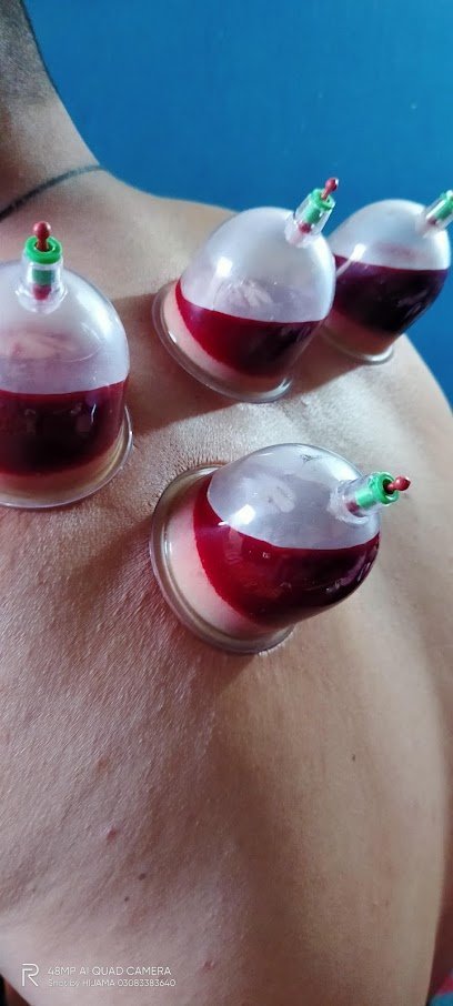 Hijama Home Services