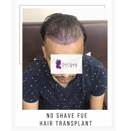 Ever Young Hair Restoration Clinic