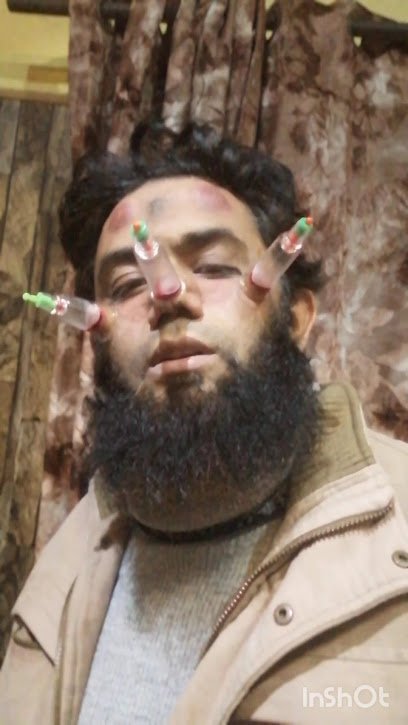 Alqasim Hijama Center