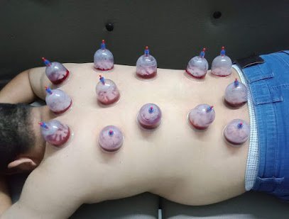 Al Hanan Hijama Clinic