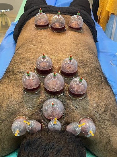 Hijama Medication Cupping Therapy