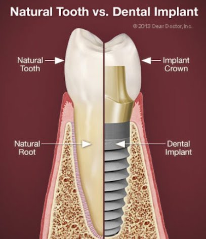Dental Comfort
