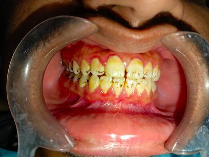 Smile Cure Dental Clinic