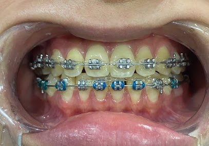 Premium Smile Dental Care