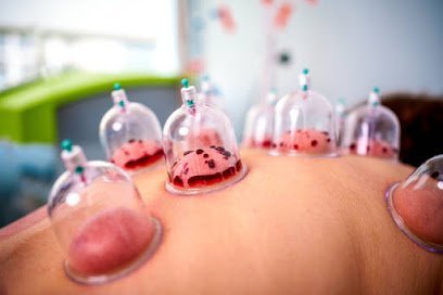 Hijama In Lahore