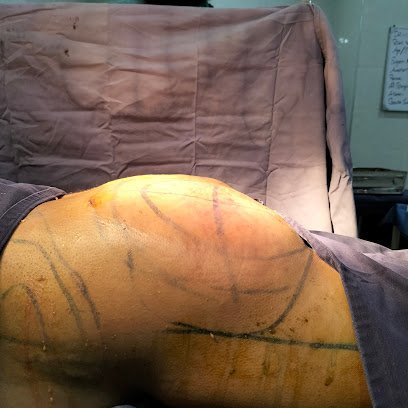 Sarfraz S Plastic Surgery And Hair Transplant