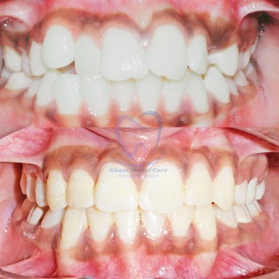 Ghani Dental Care