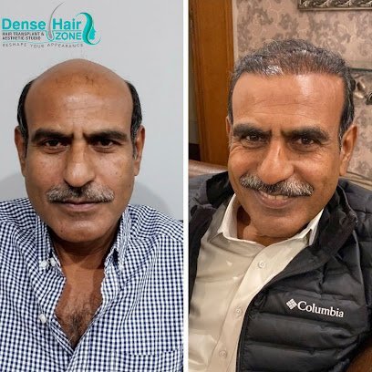 Dense Hair Zone