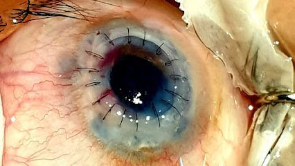 Al-Mumtaz Eye Clinic