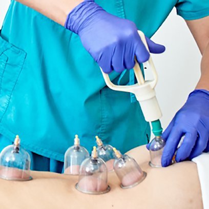 Sidhu Lahore Hijama Center