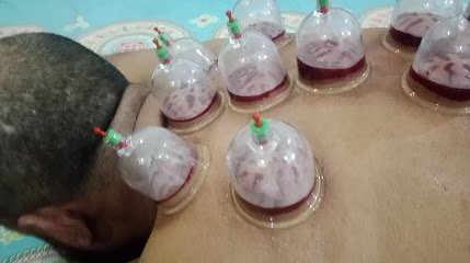 Al Madina Hijama Center