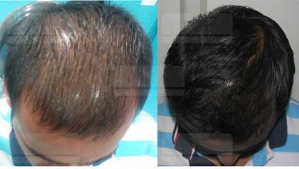 Skin And Surgery