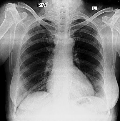 Digital Best X Ray At Home Portable