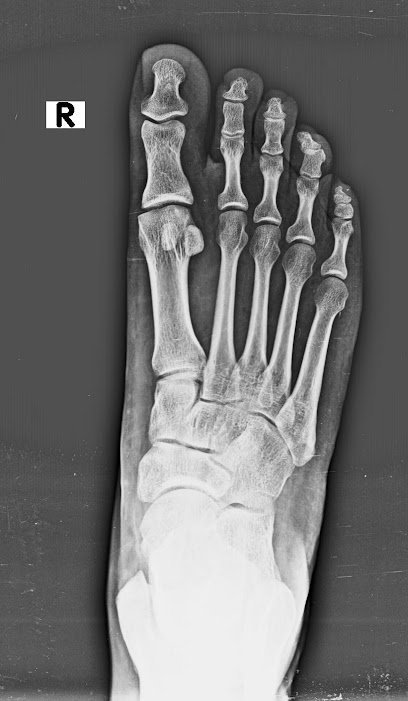 Digital Home X Ray Portable