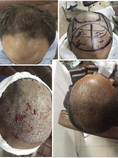Youth Hair Transplant