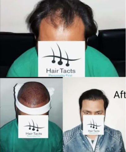 Hair Tacts Multan