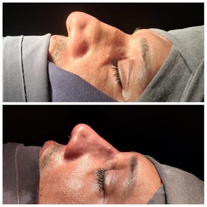 Mediplasta Hair Transplant And Aesthetic Clinic
